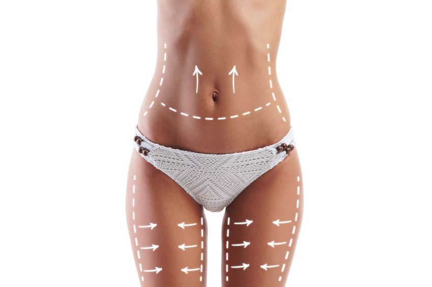 body star - zatezanje misica tela - salon lepote Impressio